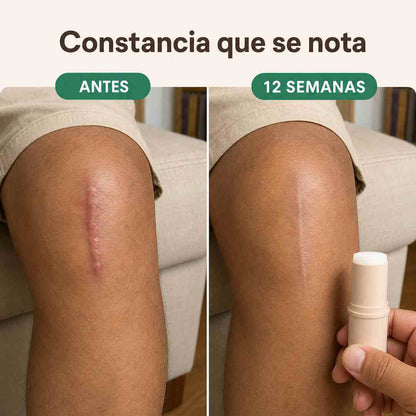 CICALISA Barra de Silicona con Centella Asiática - Cara y Cuerpo - Pago al Recibir